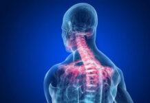 Dolore al collo: la fisioterapia in che modo può aiutare?