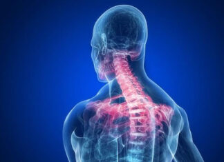 Dolore al collo: la fisioterapia in che modo può aiutare?